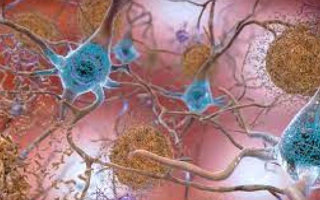 Adorando el cerebro, descuidando el cuerpo