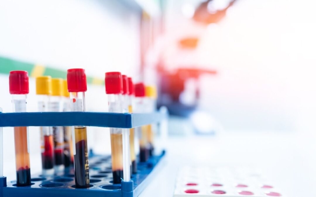 La IA encuentra biomarcadores potenciales en enfermedades neurodegenerativas